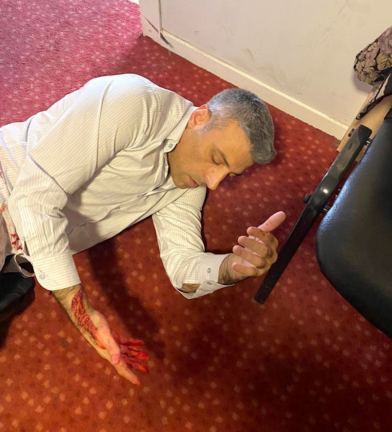 YP Genel Başkanı Yılmaz,a Bıçaklı Saldırı